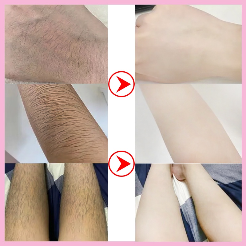 Spray Cream Krim Penghilang bulu permanen 150ml rambut Hair removal cream Rambut ketiak Penghilang bulu Bagian privat kaki Lengan Krim penghilang rambut cepat yang aman, lembut, tanpa rasa sakit, dan tidak menyebabkan iritasi