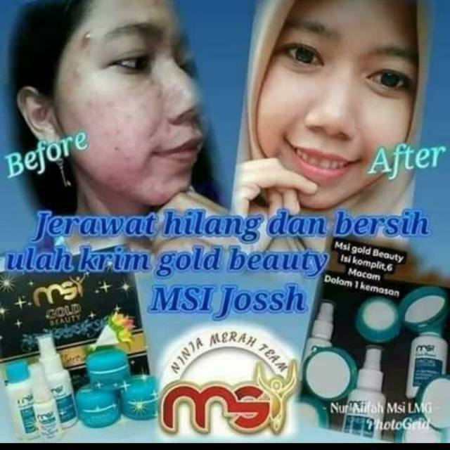 CREAM PENGHILANG FLEK HITAM MSI