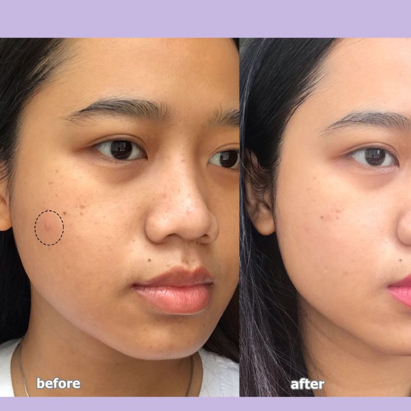 [ COD ] SCARLETT WHITENING FACE CARE / PERAWATAN WAJAH-7