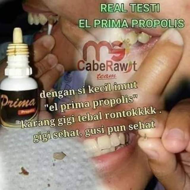 Perontok Karang Gigi Elprima Propolis MSI Original