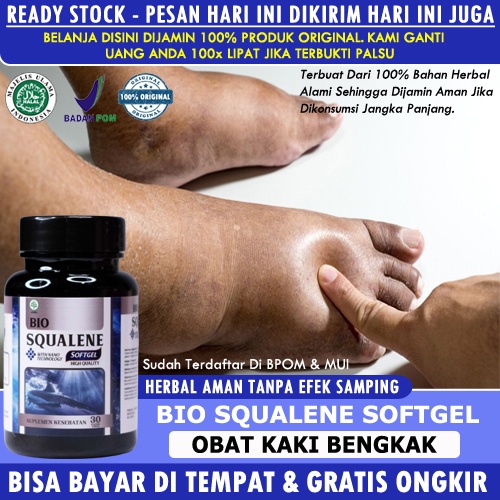 Obat Kaki Bengkak Nyeri Kaku Karena Jantung Diabetes Keseleo Pengempis Kaki Bengkak Pembengkakan Gin