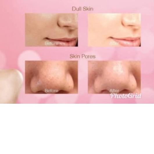 ➺ ECER Glutax 2000gs Recombine NEW ♪