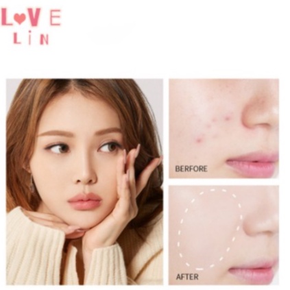 Lameila Cover Make Up Protection Concealer Penutup Noda Pada Wajah DJ 1039