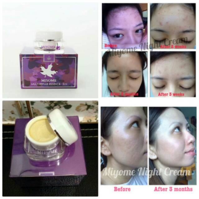 miyome cream