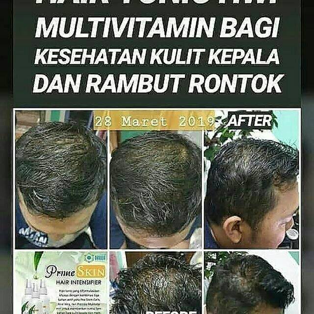 HAIR INTENSIFIER (menumbuhkan rambut)