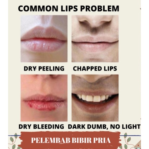 Lip Balm Pelembab Tahan Lama Pria Protect Lip Balm For Man Cocok Untuk Memerahkan Bibir Hitam dan Kering