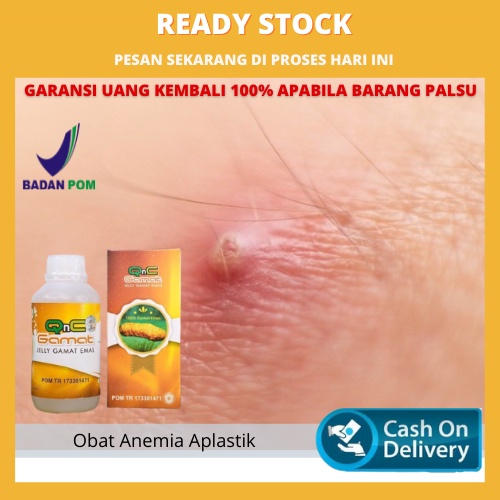 Obat Bisul, Nyeri Bisul, Obat Bisul Pecah, Nanahan, Obat Bisul Menahun Herbal Qnc Jelly Gamat Asli
