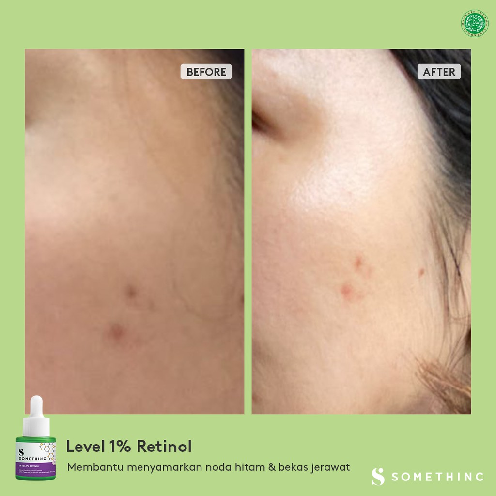 Somethinc Level 1% Retinol Penghilang Jerawat Komedo Kerutan Bruntusan Bekas Luka Wajah