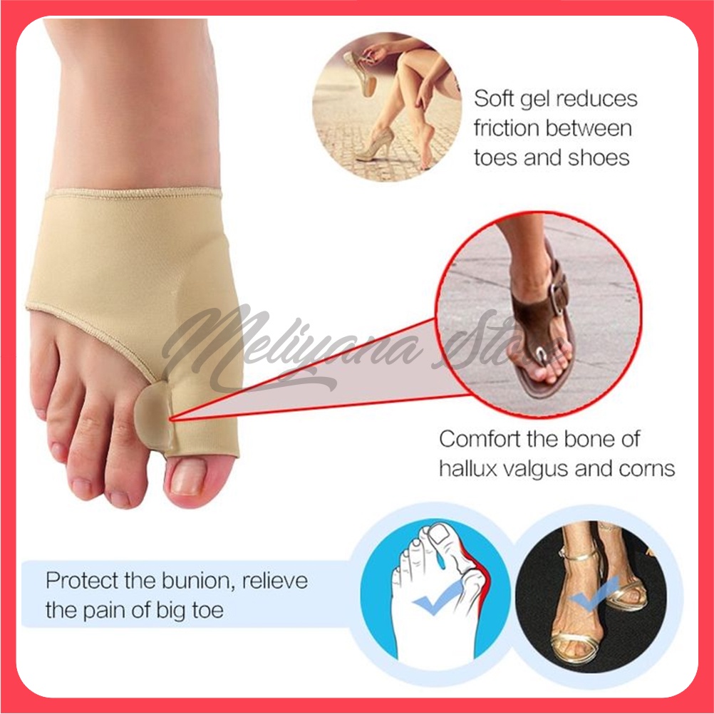 Pelurus jempol kaki, hallux valgus. splint , bunion pad, night splint