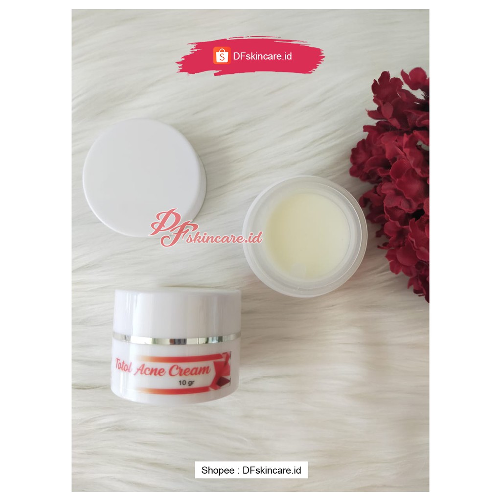 Jual Tutul Acne Cream (Cream Jerawat) Shopee Indonesia