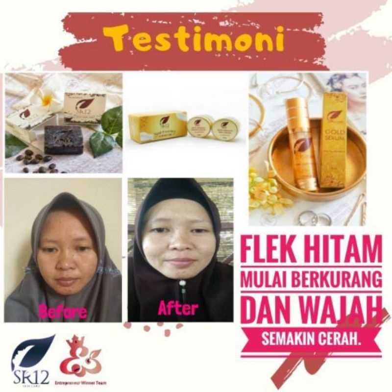 Penghilang flek,Pencerah wajah,anti aging,serum glowing/GOLD SERUM SR12