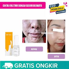 [COD] Dermayu Serum Vitamin C Lightening AMPUH Mengatasi Kulit Berminyak &amp; Mengencangkan Kulit  I 100% Original BPOM