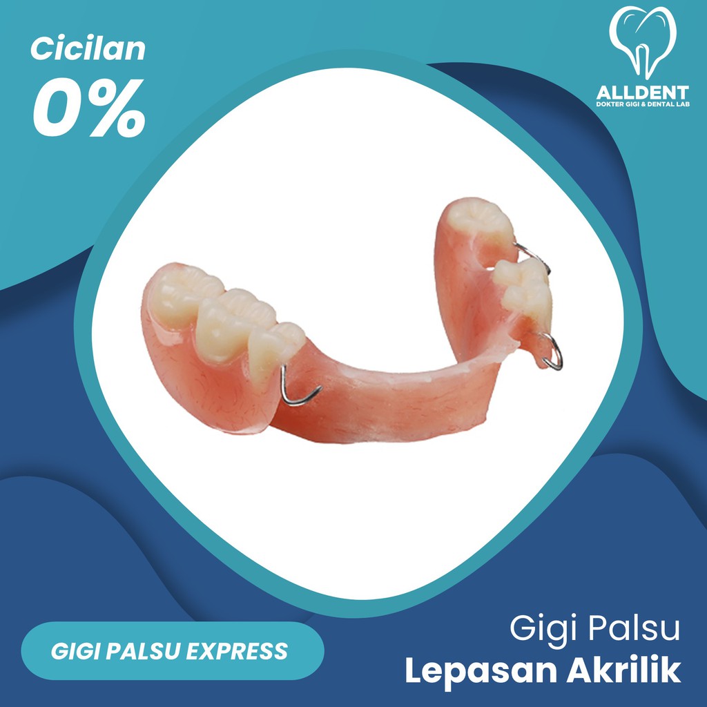 Express Gigi Palsu Lepasan Akrilik