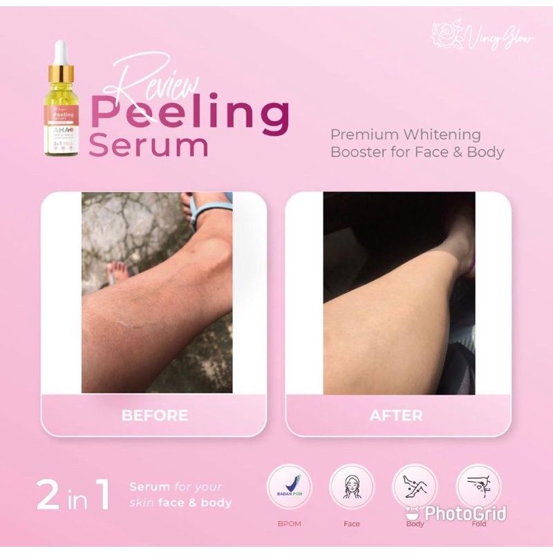 AHA Peeling Serum Whitening Booster by Vincy Glow