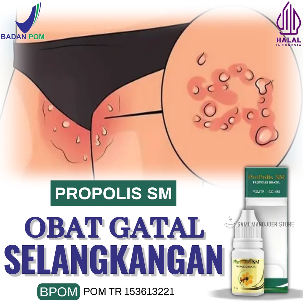 COD Obat Selangkangan Lecet, Selangkangan Gatal, Krim Gatal di Selangkangan, Salep Selangkangan, Oba