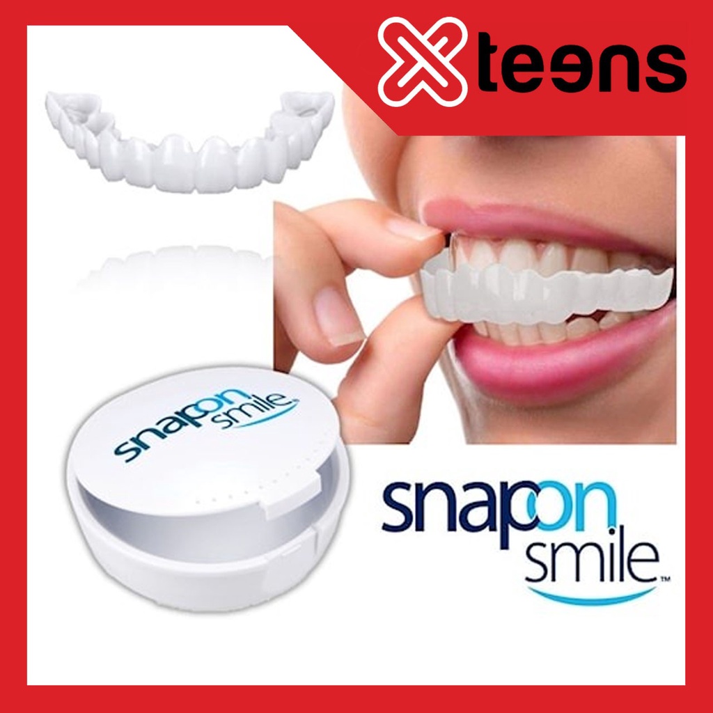 Snap On Smile Gigi Palsu 1 Set Atas Bawah - Gigi Palsu Silikon