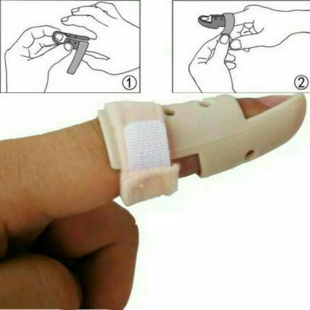 Finger splint, penyangga jari,