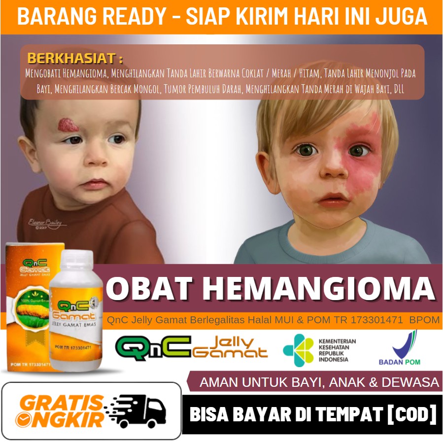 Obat Salep Hemangioma Untuk Bayi, Penghilang Hemangioma, Obat Luka Hemangioma, QnC Jelly Gamat Alami