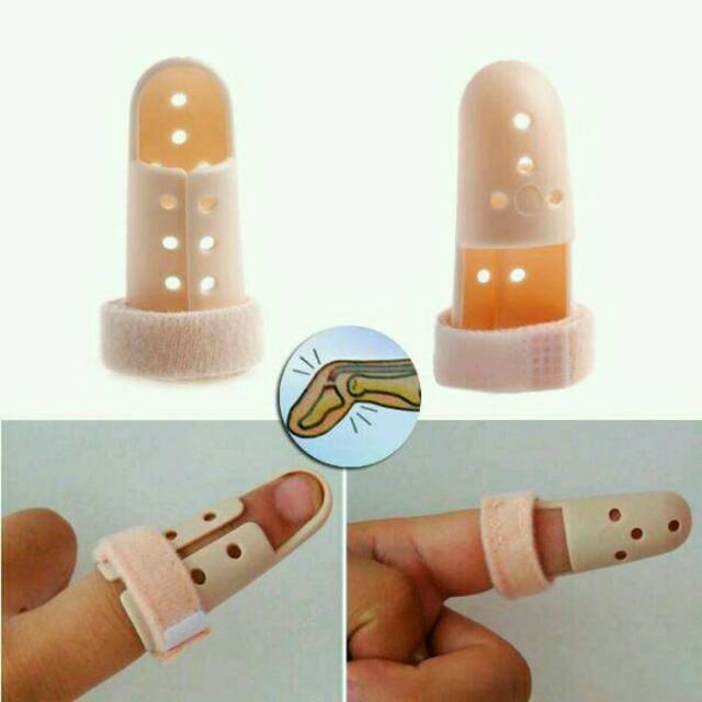 Finger splint, penyangga jari,