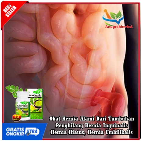 Obat Hernia Alami Dari Tumbuhan, Penghilang Hernia Inguinalis, Hernia Hiatus, Hernia Umbilikalis - K