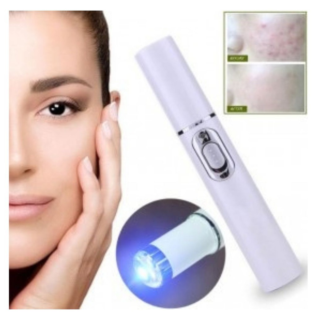 Laser Pen Alat Penghilang Jerawat Blue Light Ray Acne Treatment 111