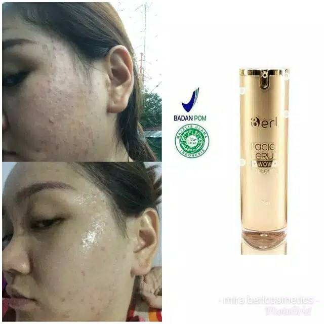 B ERL FACIAL SERUM COSMETICS -ALEXAGROSIR