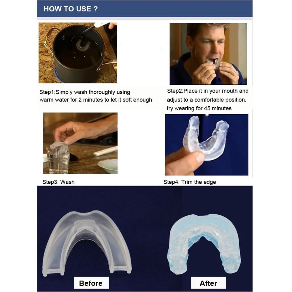 COD Stop Snoring Solution Mouthpiece / Alat Bantu Ngorok Alat Mendengkur Anti Dengkur Ngorok Mendengkur Snore Snore Snoring Penghilang Ngorok