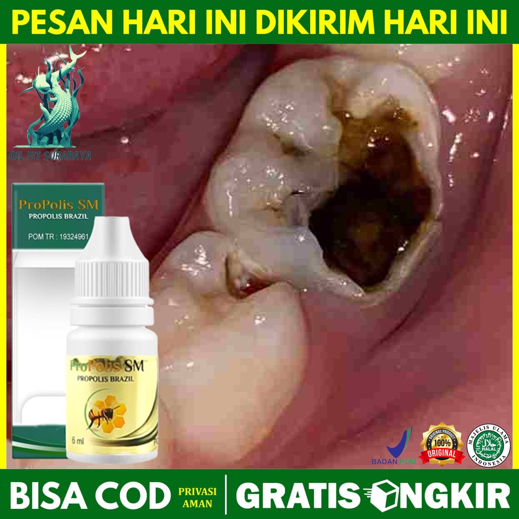 Obat Tetes Sakit Gigi Berlubang - Sakit Gigi Nyut Nyutan Untuk Anak Dan Dewasa - Gusi Bengkak - Obat