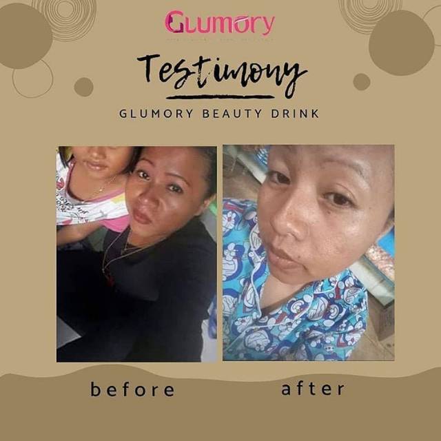 GLUMORY Health &amp; Beauty Solusi Jerawat Kulit Sehat Cerah