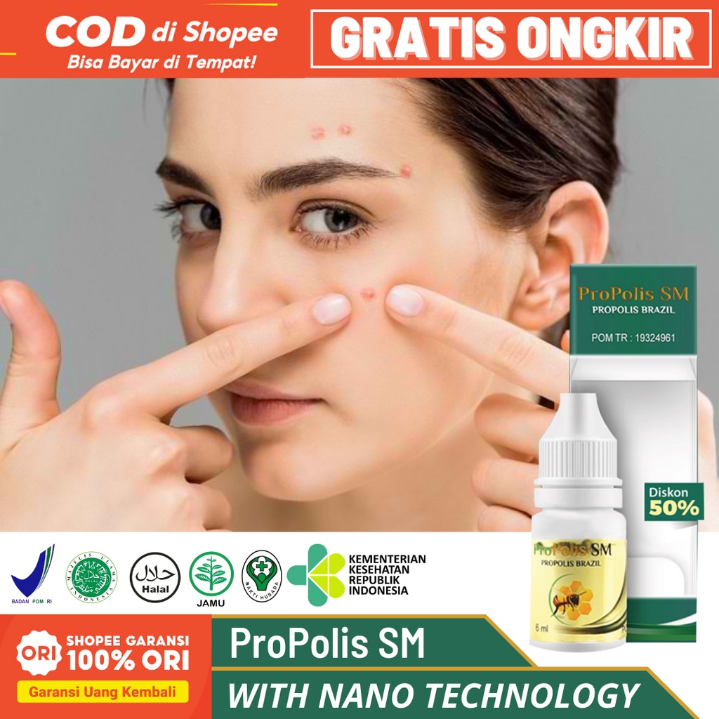 ProPolis SM Obat Jerawat, Obat Jerawat dan Bekas Jerawat, Penghilang Bekas Jerawat