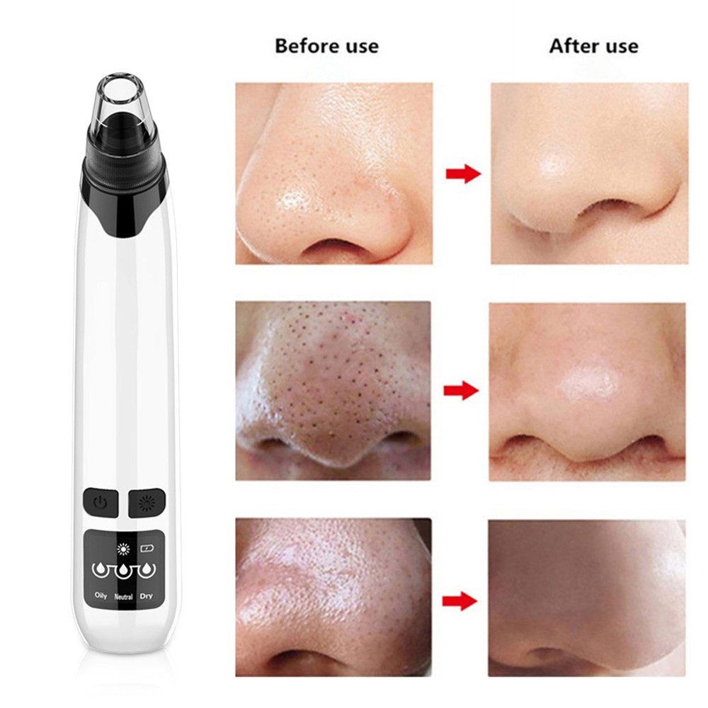 Alat Penyedot / Vaccum Komedo Microcrystalline Remove Blackhead Komedo