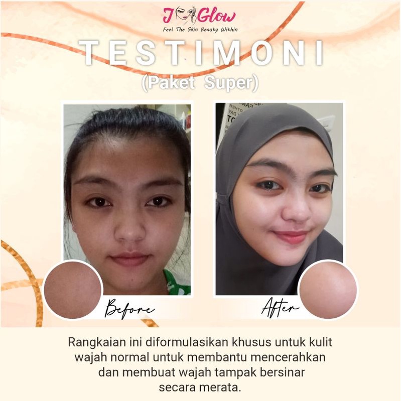 Jglow Skincare Paket Super Whitening Skin Cream glowing(KEMASAN BARU PAKET RADIANCE)