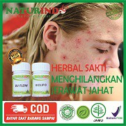 OBAT HERBAL jerawat batu bisulan kurap badan udunan jamur kurap keras gatal kurap bisul menir