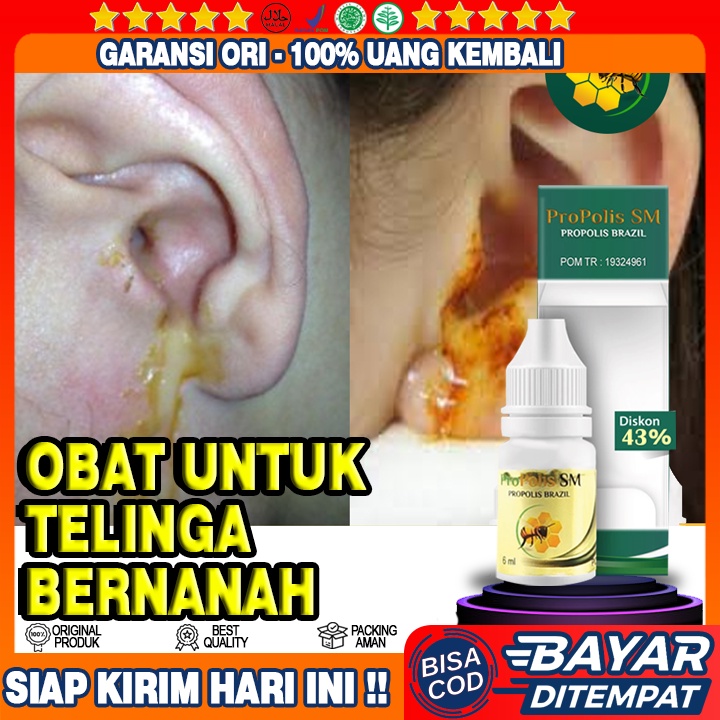 Obat Telinga Bernanah, Obat Penghilang Nanah Di telinga, Obat Tetes Telinga Bernanah, Propolis SM