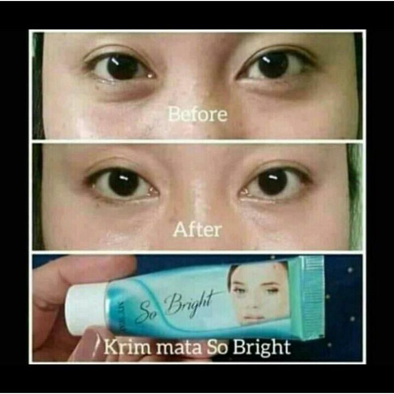 So Bright Eye Contour Mengatasi Mata Panda My Way Import Dari Mesir