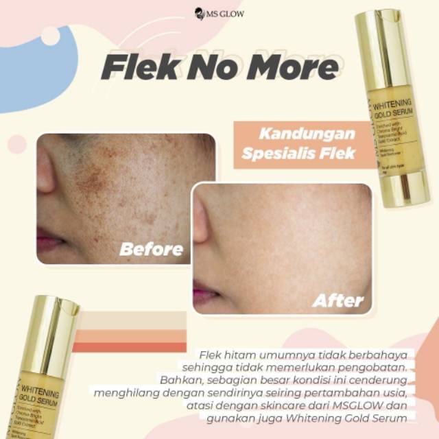 Whitening Gold Serum MS Glow / Serum Gold / Serum mencerahkan / Menghilangkan flek / Original 100%