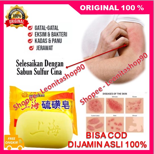 BELI 1 GRATIS 1 Shanghai Sulfur Soap Sabun Sulfur Cina Sabun Belerang Cina Obat Gatal Cina Ampuh 100