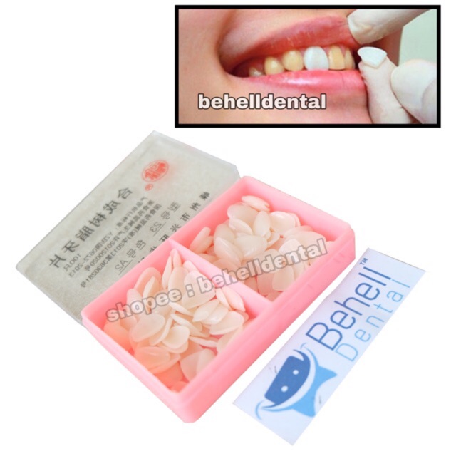 Veneer Gigi Gigi Kelinci Veener Vener Isi 50 Atas Bawah Super White Shopee Indonesia