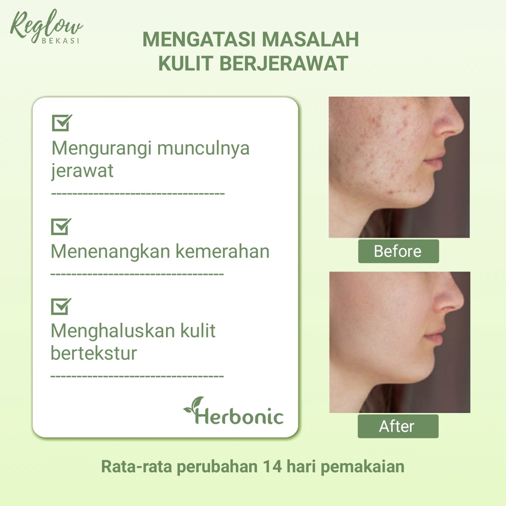 REGLOW Skincare Original BPOM Glowing Skin Treatment Paket Wajah Glowing Perawatan Kecantikan Pemutih Wajah Facial Wash Toner Cream Micellar Water Pembersih Wajah Penghilang Jerawat Flek Hitam Noda Hitam Bruntusan kerutan Inflamasi-7