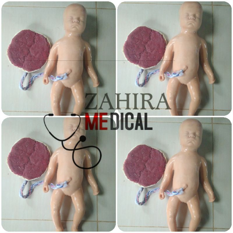 PHANTOM MANIKIN / MANEKIN BAYI PLASENTA SILICONE