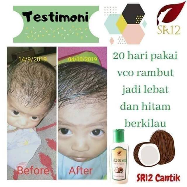 Download Virgin Coconut Oil Untuk Rambut Pictures