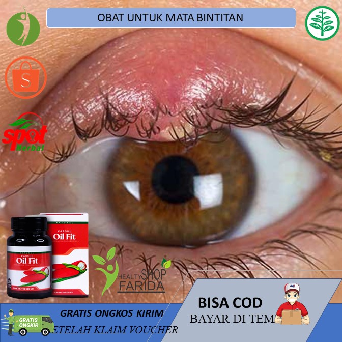 Jual Obat Mata Bintitan Obat Pengempis Mata Bintitan Bintil Kecil Benjolan Kelopak Mata