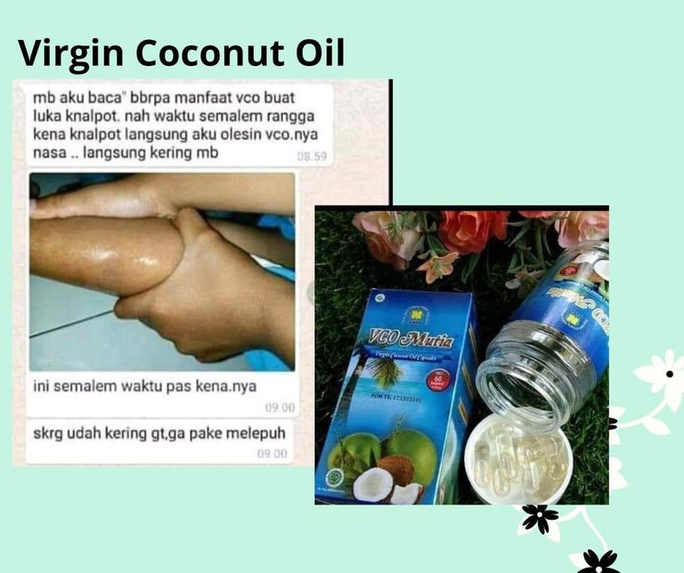 

∆MARISAH∆ Virgin Coconut Oil Capsul