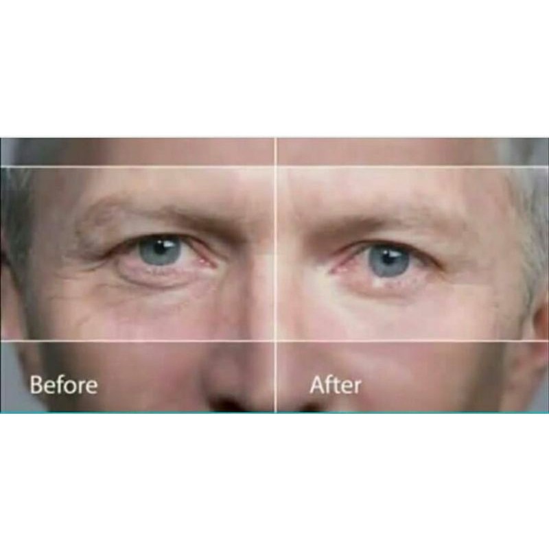 ageless penghilang kantung mata dalam 2 menit
