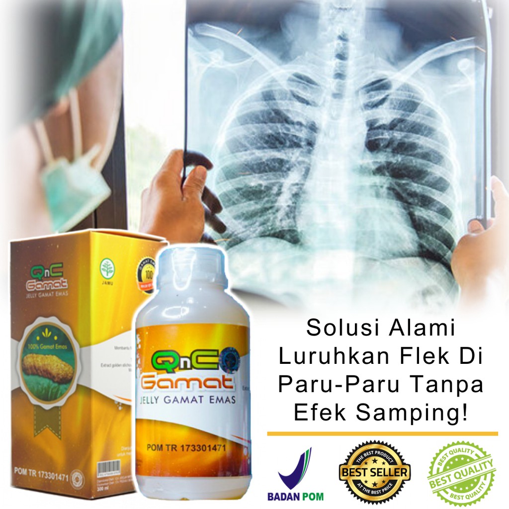 Obat Untuk Mengatasi Flek Di Paru Paru Anak dan Dewasa