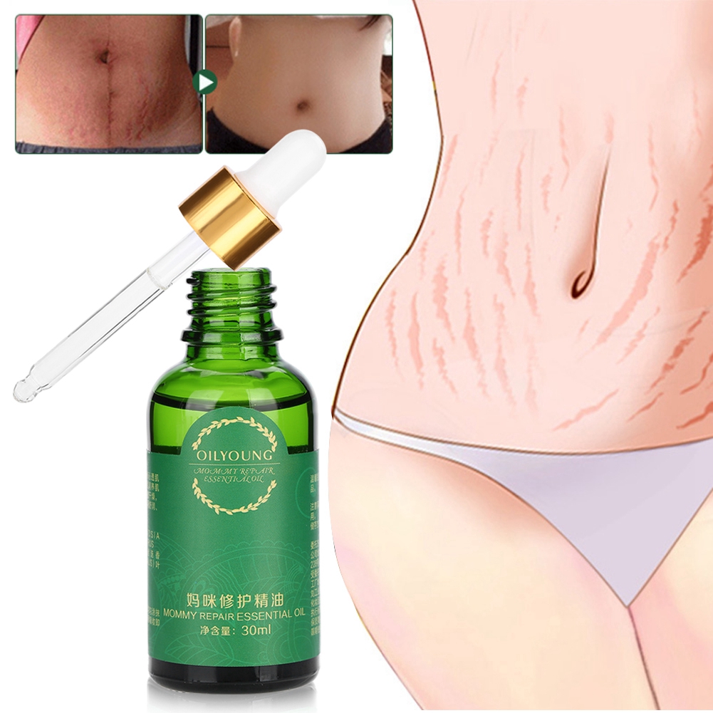 Minyak Pijat Penghilang Stretch Mark Untuk Ibu Hamil Shopee Indonesia