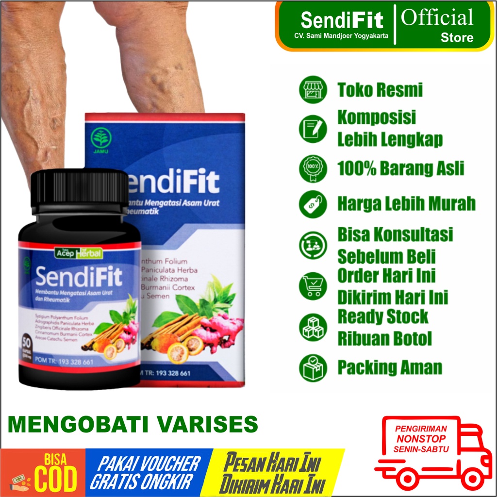 Obat Varises Pembuluh Vena Bengkak Menonjol Di Permukaan Kulit Nyeri Dan Berdenyut Dibagian Tungkai 