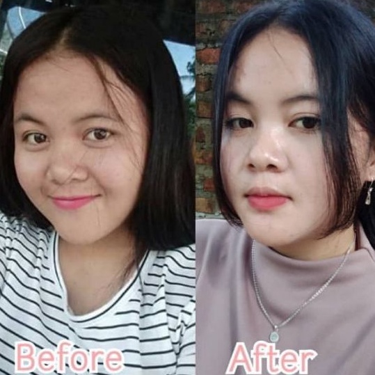 Daviena skincare medan - Glowing series Komplit / Paket Hemat Daviena Best seller-6