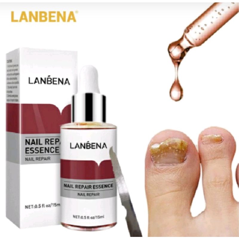 PENGHILANG JAMUR KUKU LANBENA SERUM