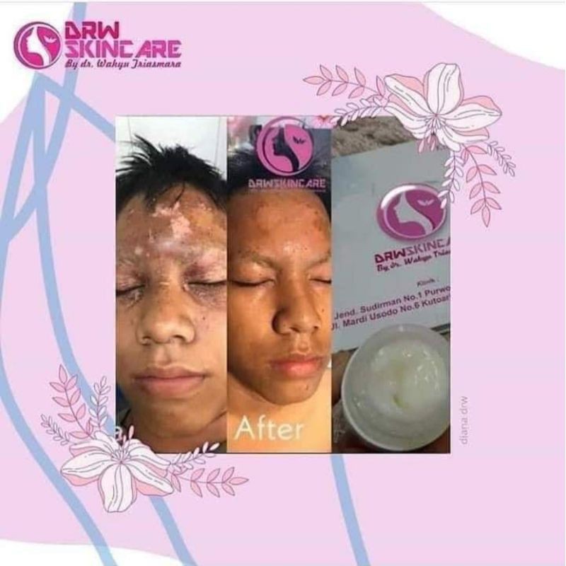 snail cream with honey